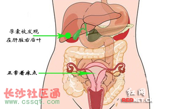 KλǳҊ2015HӢīI(xin)(bo)^ȥ60ȫH(bo)^22
